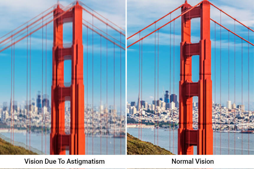 astigmatism-vision.jpg