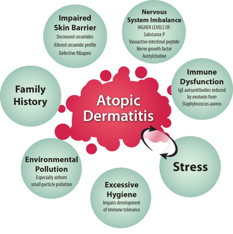 atopic-dermatitis-768x774.jpg