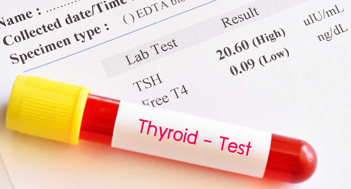 Cabot-Health-Thyroid-Blood-Test.jpg