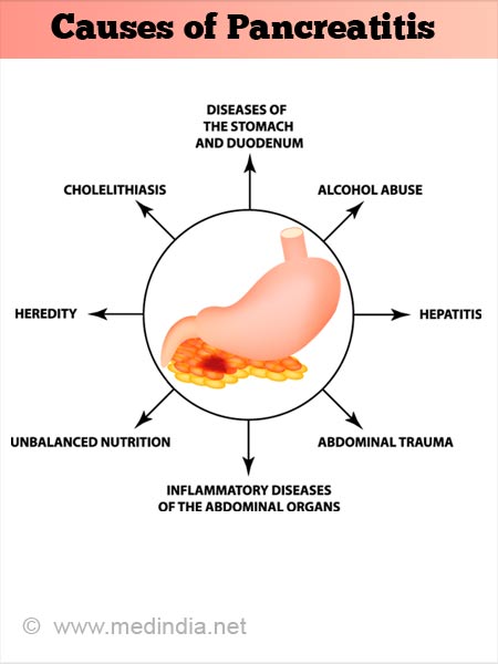 causes-of-pancreatitis.jpg