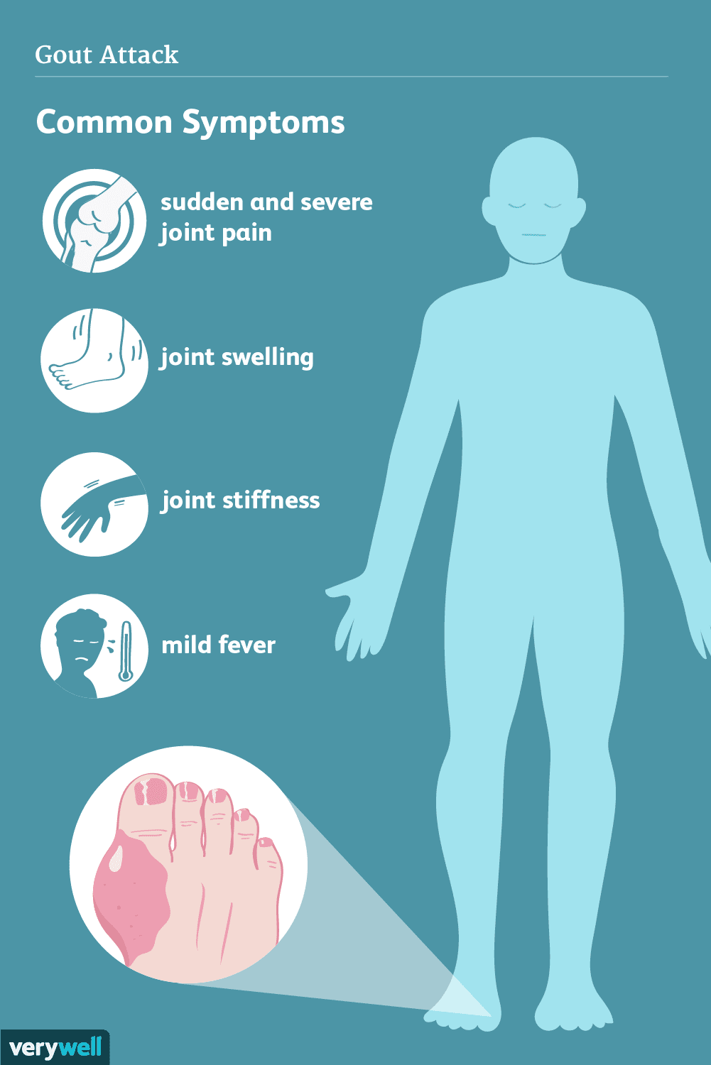 gout-symptoms-5af9db9eff1b780020e211ee.png