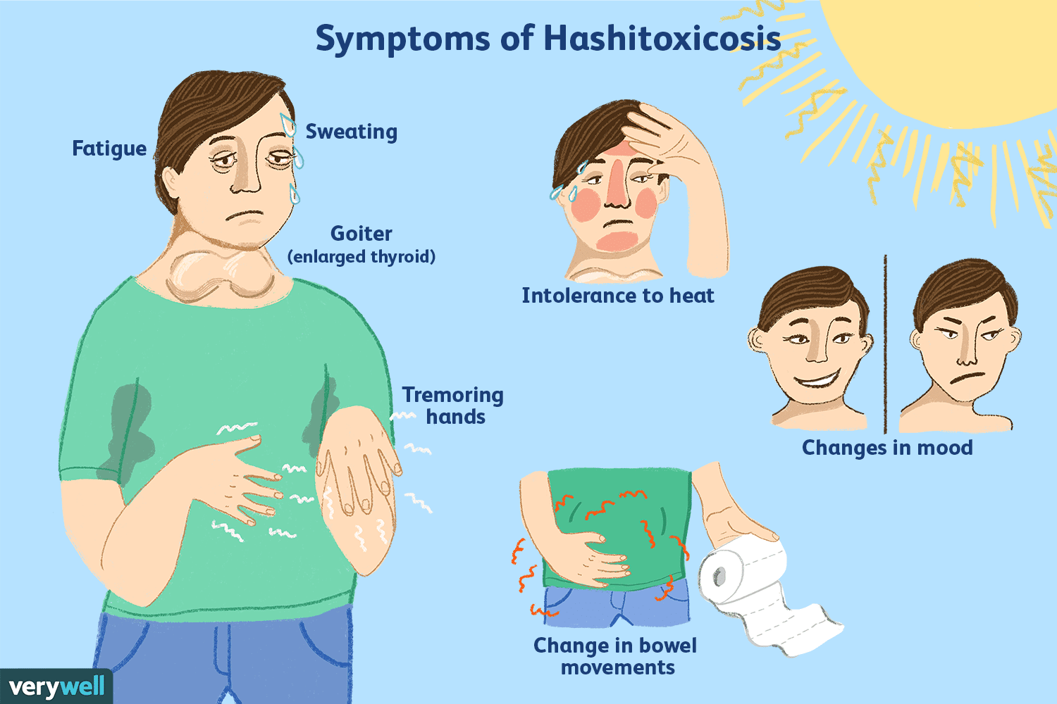 hashitoxicosis-overview-4582192-v2-5c82b37fc9e77c0001a67621.png