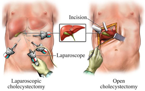 laparoscopic.jpg