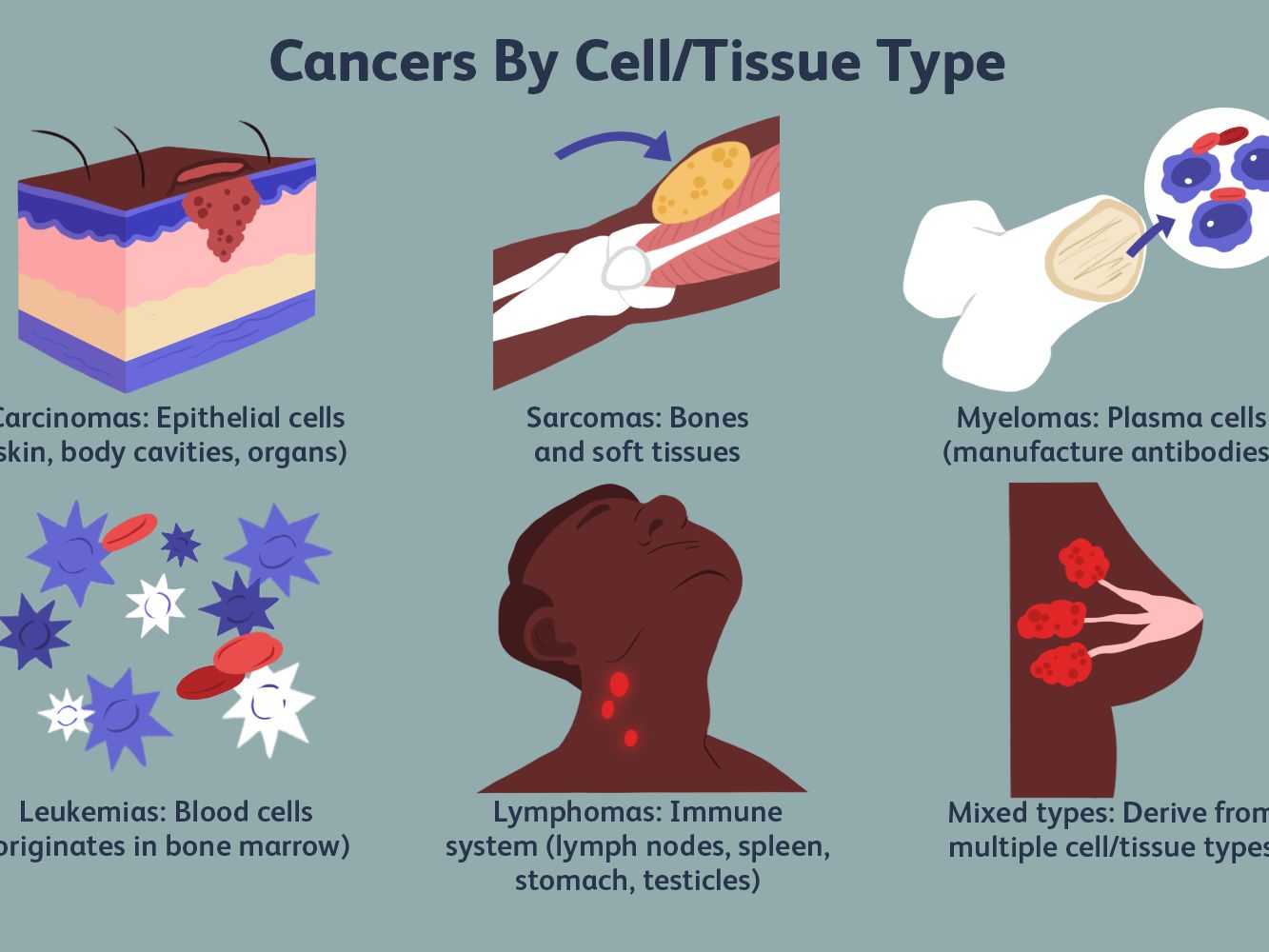 more-cancer-types-4158486_final1-32133bd225444ae0a3b6be96d62de7bf.jpg