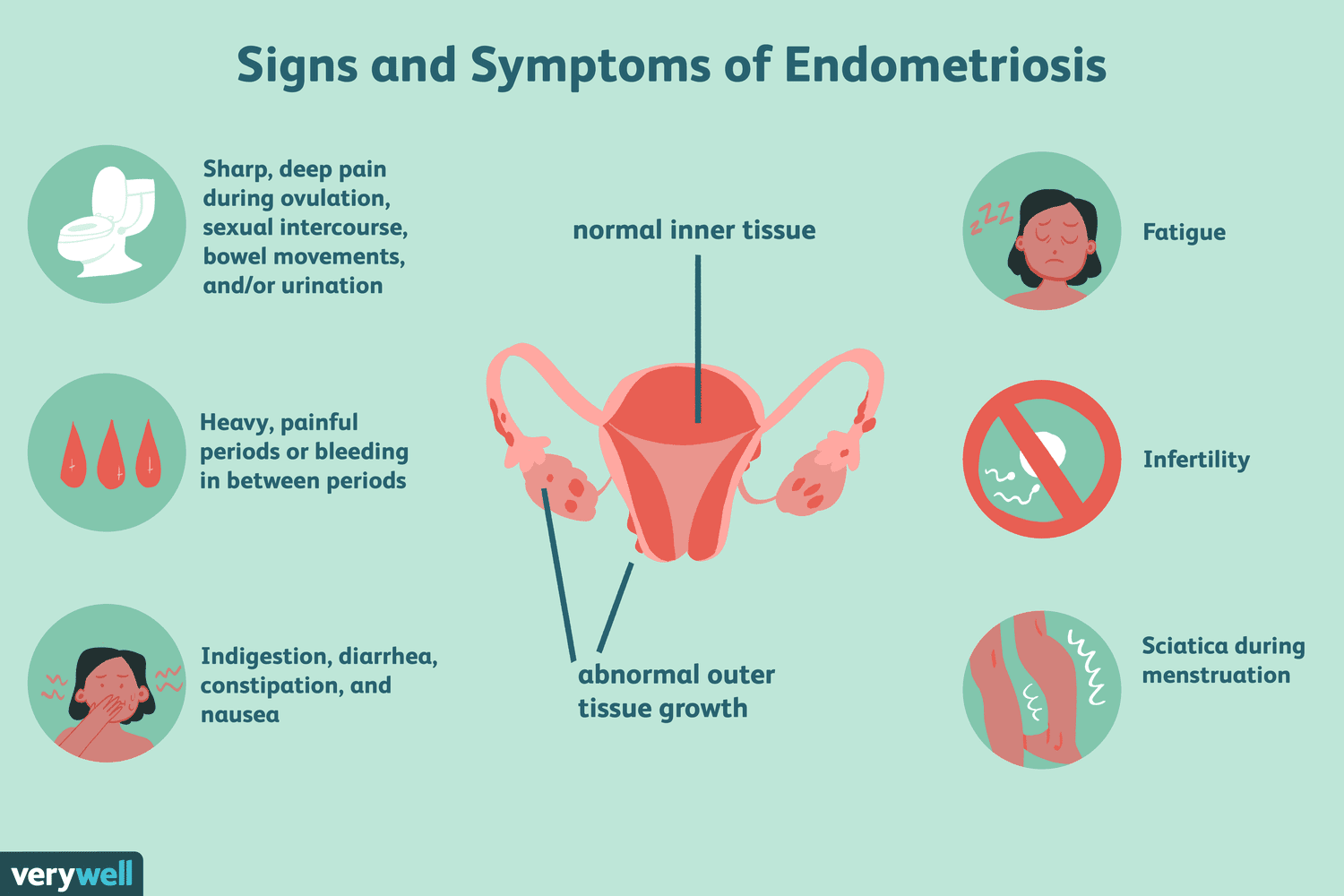 natural-treatments-for-endometriosis-89275_redraw_color1-5c454e9b46e0fb00012da9c8.png