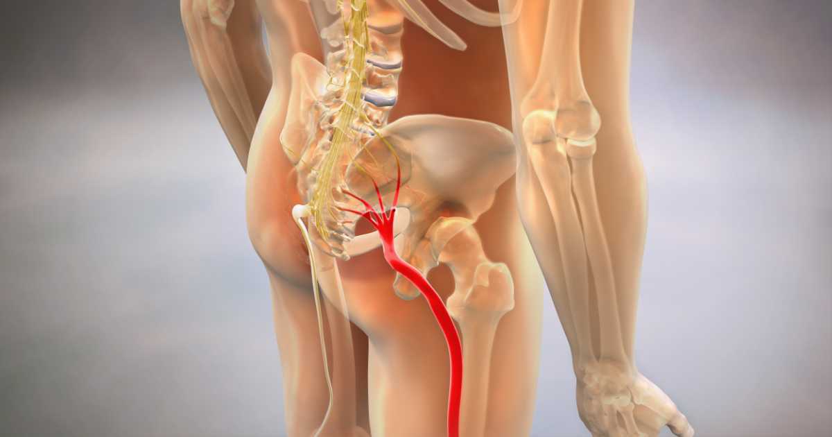 nerve-pain-leg-sciatica.jpg