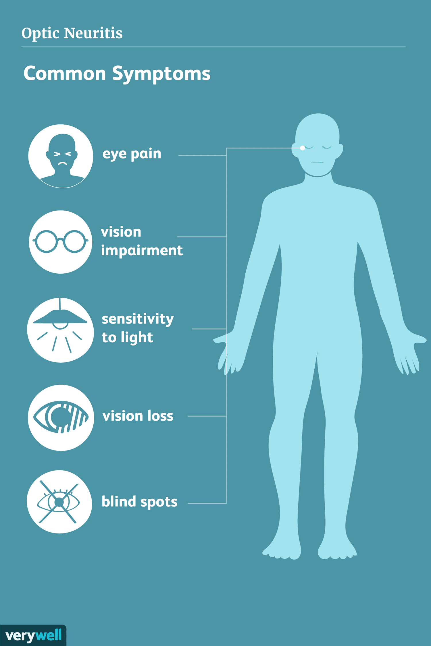 optic-neuritis-multiple-sclerosis-symptom-2440807_v2-4193b934b27d43ac834a7518181aa96e.png