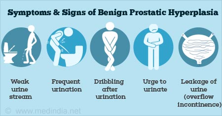 symptoms-and-signs-of-benign-prostatic-hyperplasia.jpg