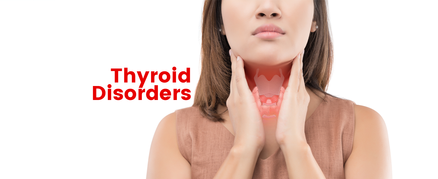 Thyroid-Disorders.png