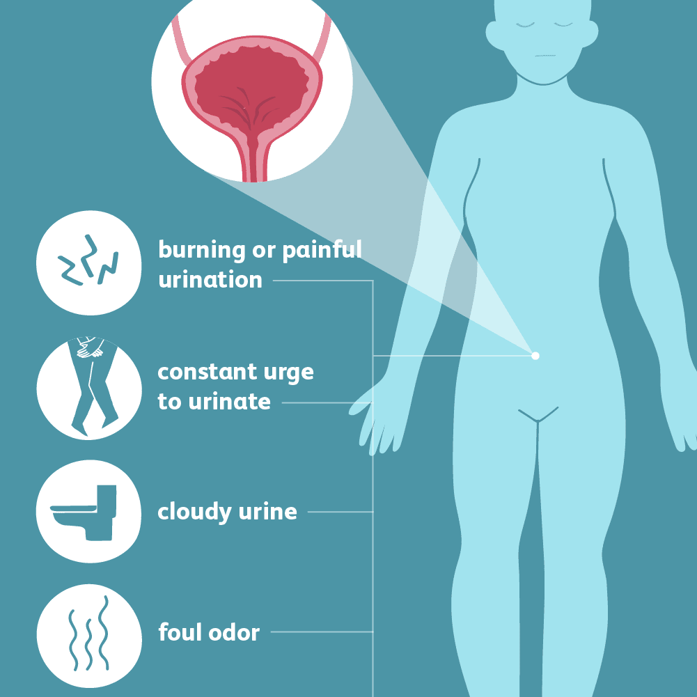 UTI-symptoms-5ad8bbf5642dca003692d55e.png