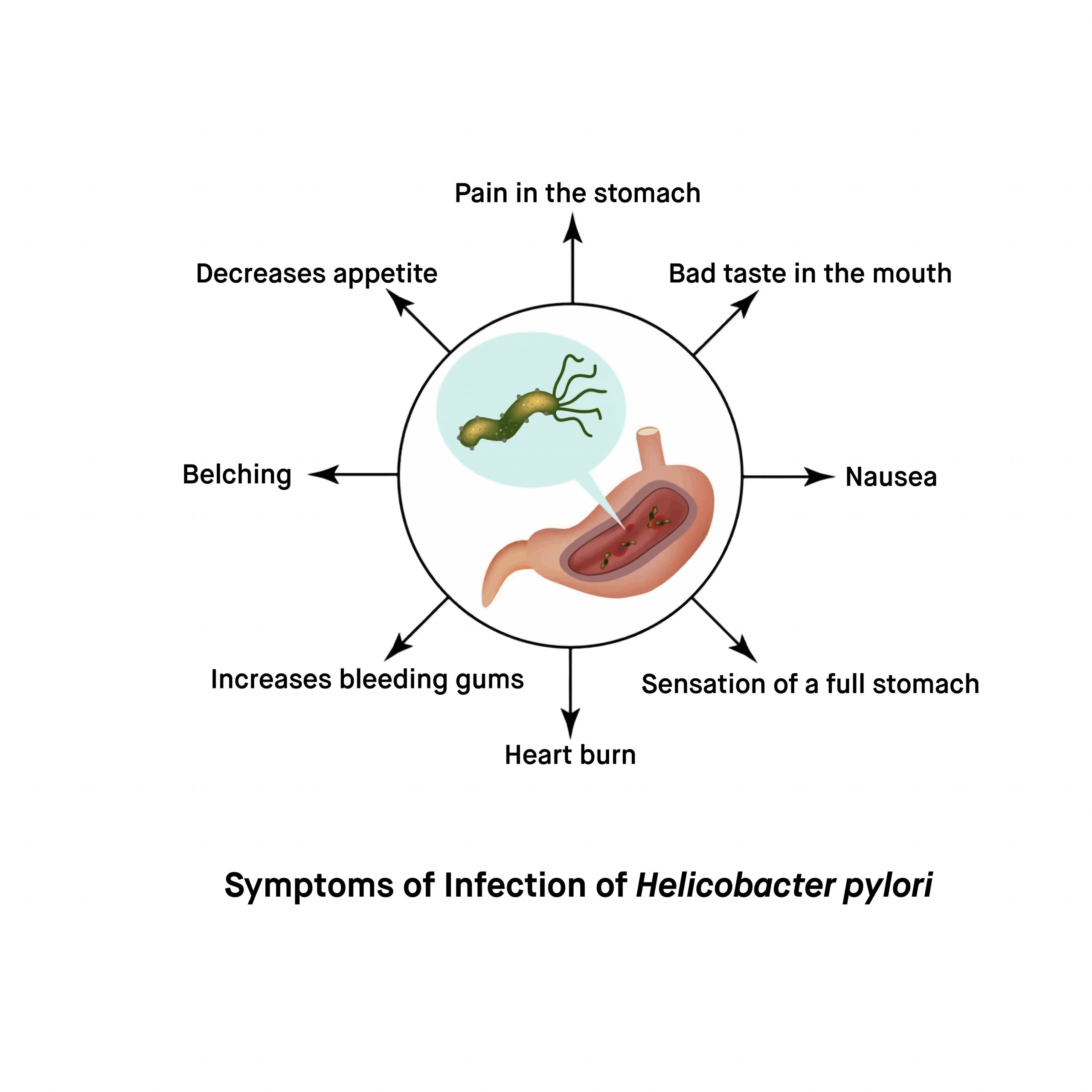 What-are-the-signs-and-symptoms-of-Helicobacter-pylori-H.-pylori-Infection-scaled.jpg