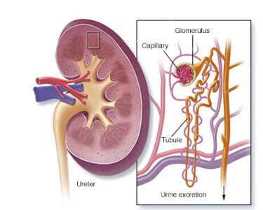 Статии - Остра Бъбречна Недостатъчност - Симптоми, Усложнения и Превенция