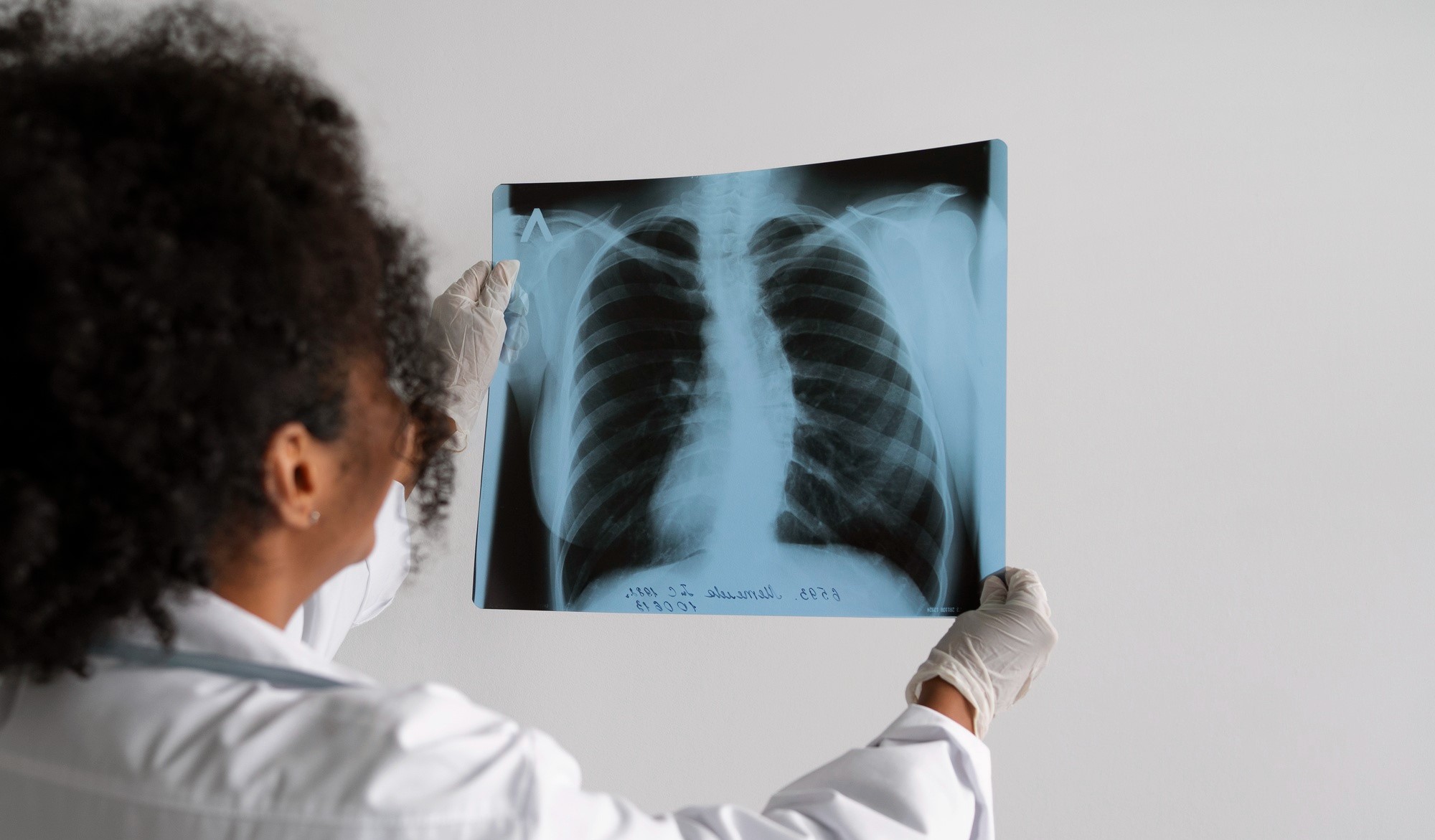 Articles - Cancer du poumon : quels sont les premiers symptômes et comment collecter des fonds pour le traitement ?