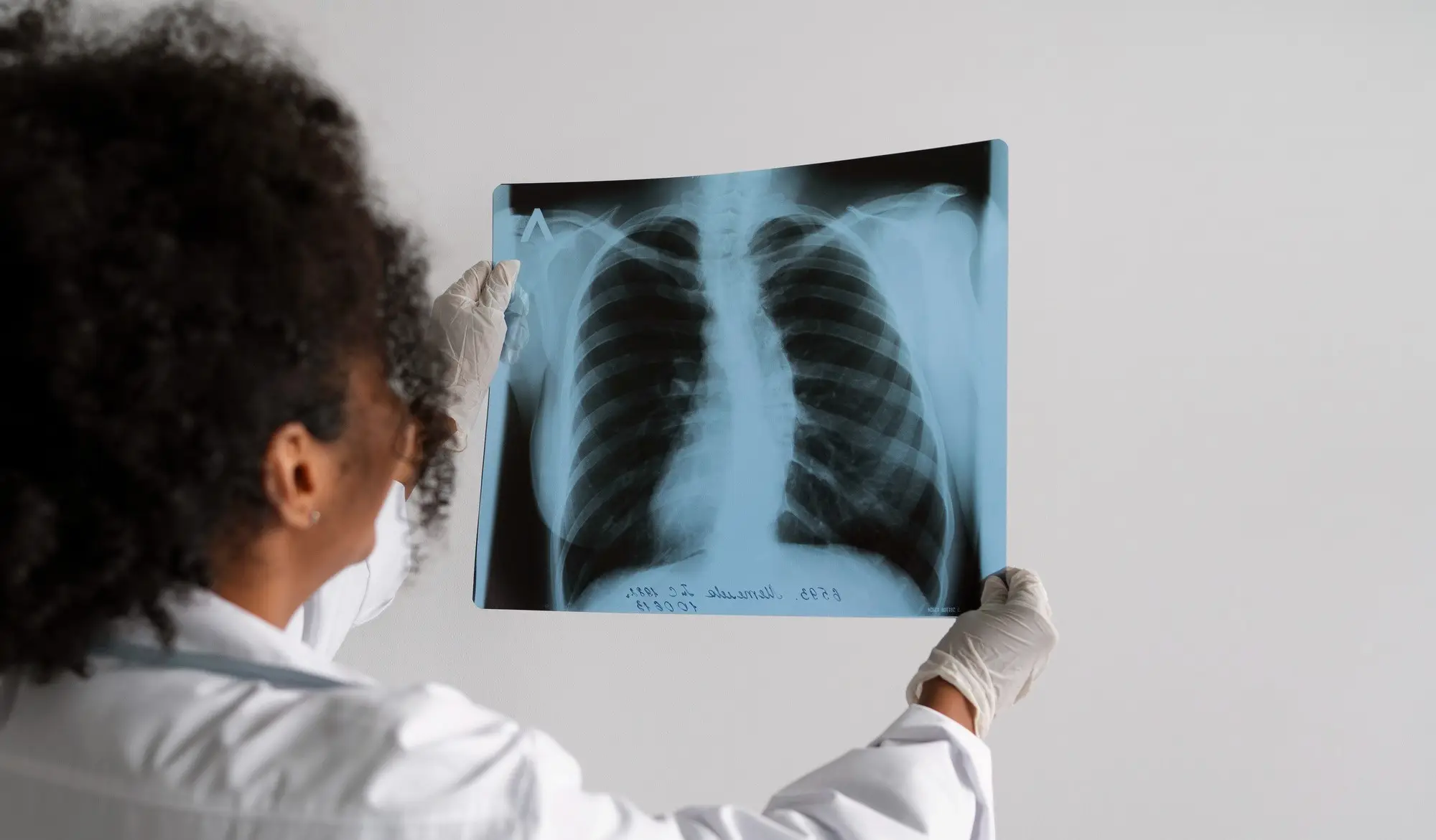 Artykuły - Rak płuc: jakie są wczesne objawy i jak zebrać fundusze na leczenie?