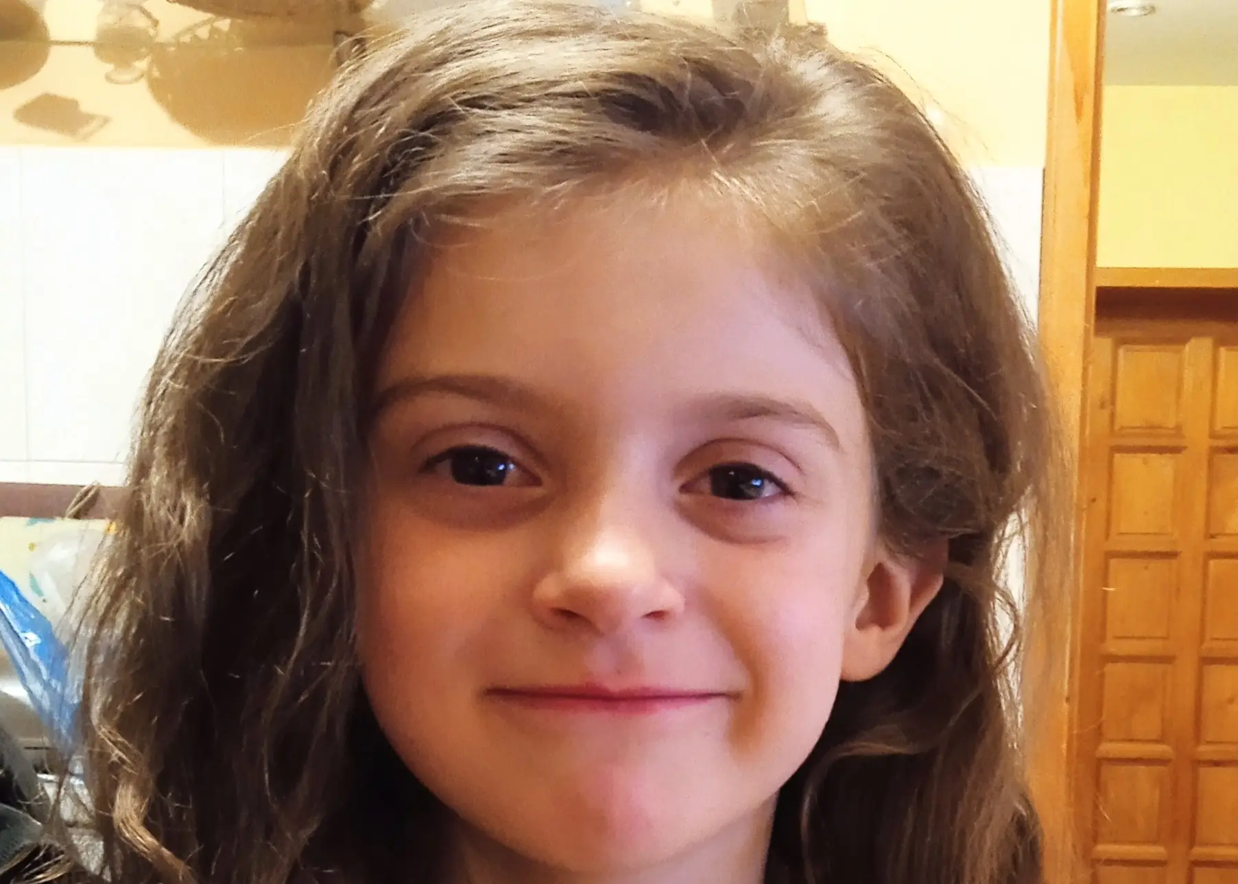 Success stories - Anastasia successfully underwent the surgery! Hats off to you, dear donors!