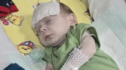 Двомесечното бебе Светозар додека се бори за својот живот во болница.